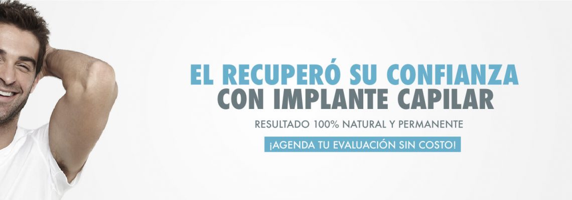 Implante-capilar-banner-min